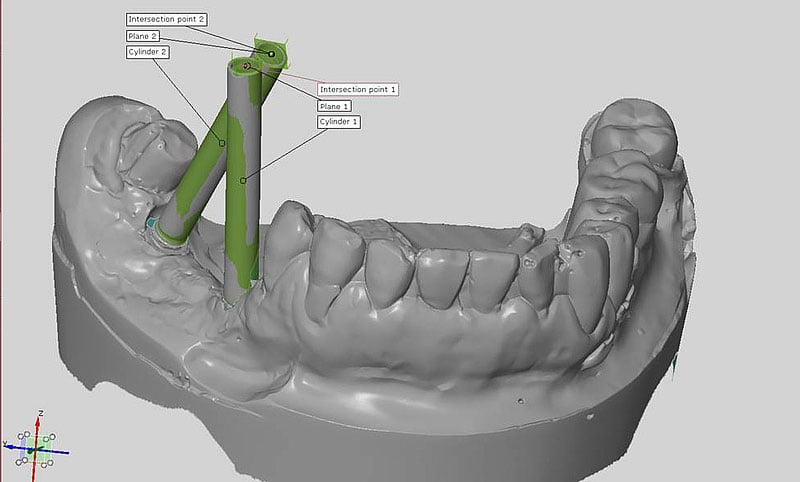 ATOS 3D scan of a mouth 