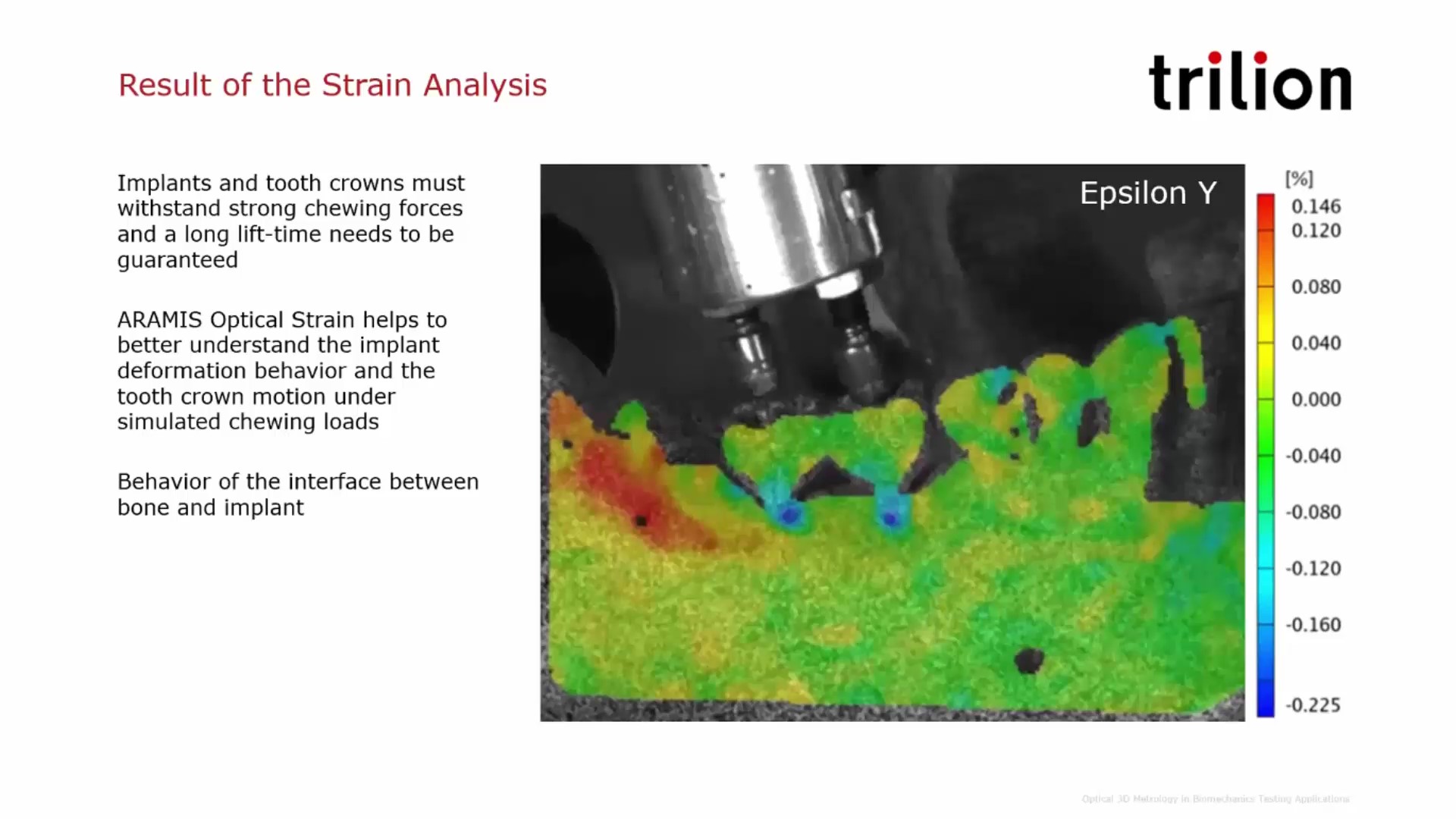 Strain Analysis on Tooth Implant using ARAMIS Optical Testing System